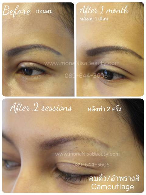 ลบคิ้ว ลบขอบตา