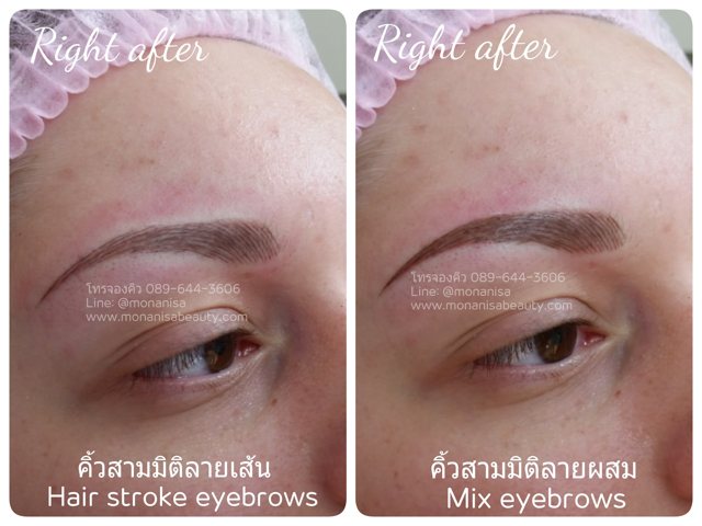 คิ้วสามมิติแบบผสม