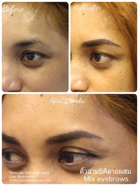 คิ้วสามมิติแบบผสม