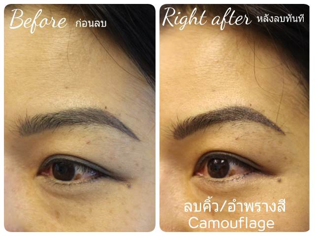 ลบคิ้ว ลบขอบตา