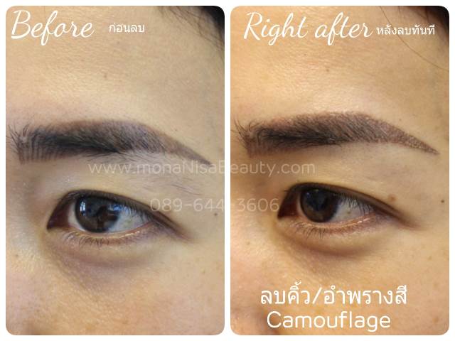 ลบคิ้ว ลบขอบตา