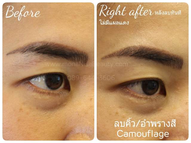 ลบคิ้ว ลบขอบตา