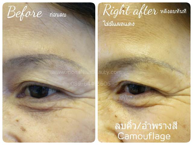 ลบคิ้ว ลบขอบตา