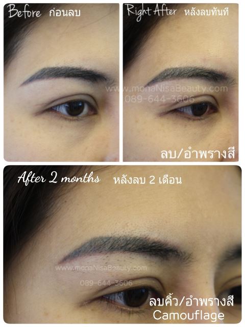 ลบคิ้ว ลบขอบตา