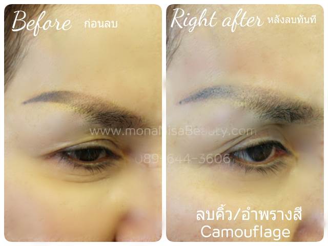 ลบคิ้ว ลบขอบตา