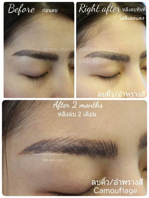 ลบคิ้ว ลบขอบตา