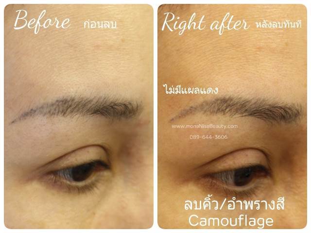 ลบคิ้ว ลบขอบตา