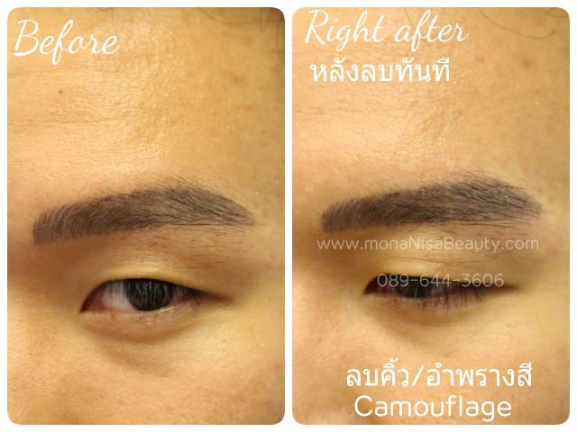 ลบคิ้ว ลบขอบตา