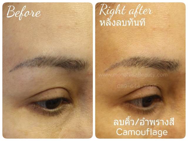 ลบคิ้ว ลบขอบตา