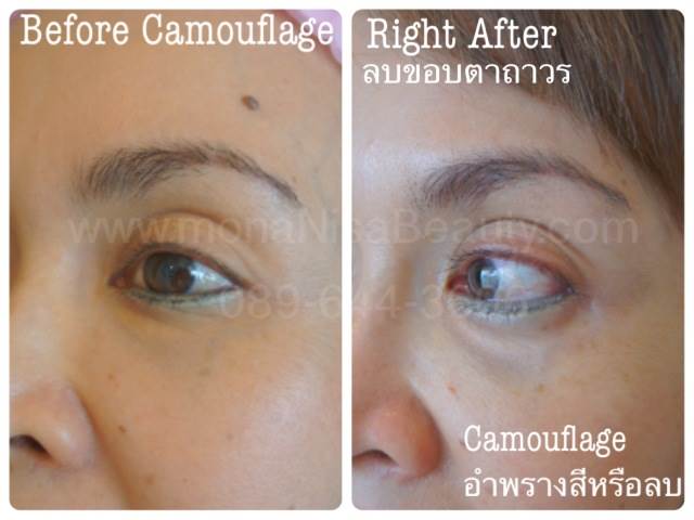 ลบคิ้ว ลบขอบตา