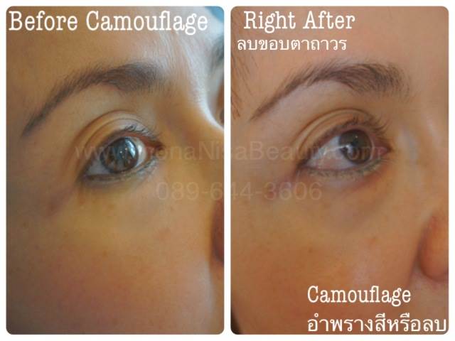 ลบคิ้ว ลบขอบตา