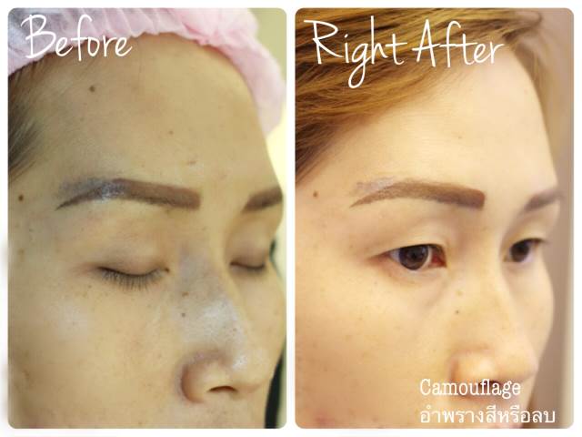 ลบคิ้ว ลบขอบตา