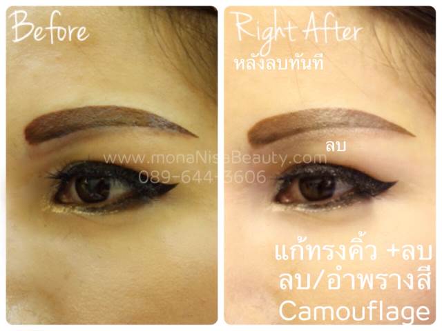 ลบคิ้ว ลบขอบตา