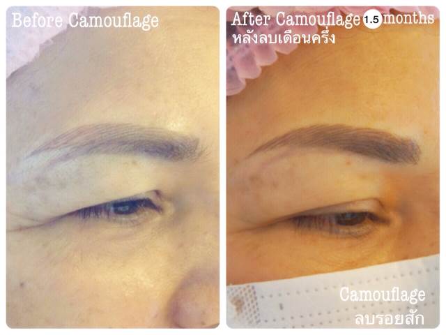 ลบคิ้ว ลบขอบตา