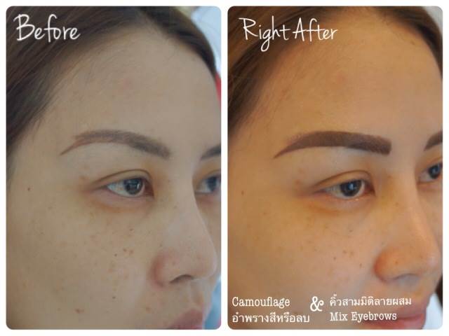 ลบคิ้ว ลบขอบตา