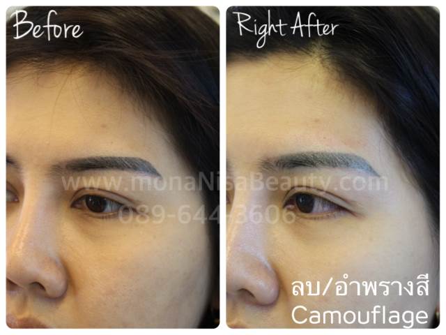 ลบคิ้ว ลบขอบตา