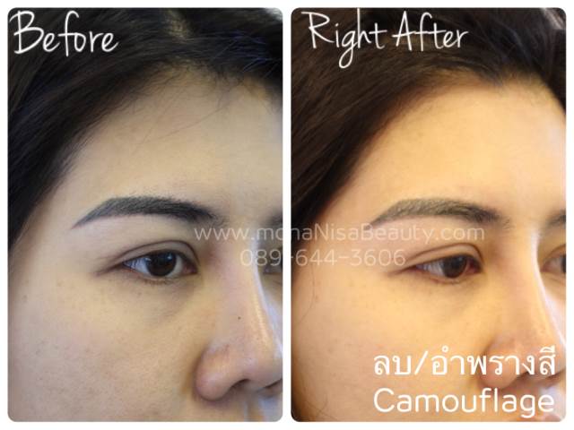 ลบคิ้ว ลบขอบตา