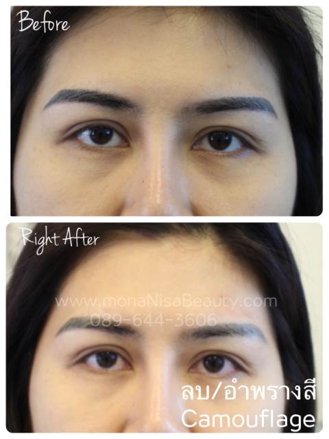 ลบคิ้ว ลบขอบตา