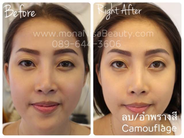 ลบคิ้ว ลบขอบตา