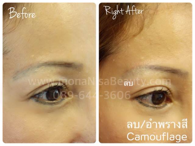 ลบคิ้ว ลบขอบตา