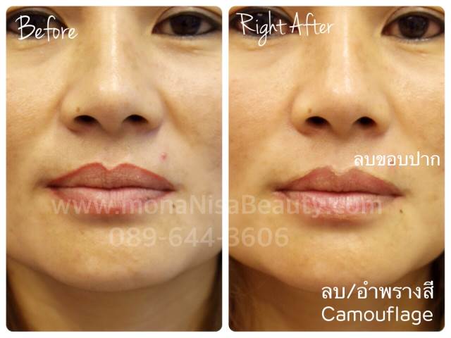 ลบคิ้ว ลบขอบตา