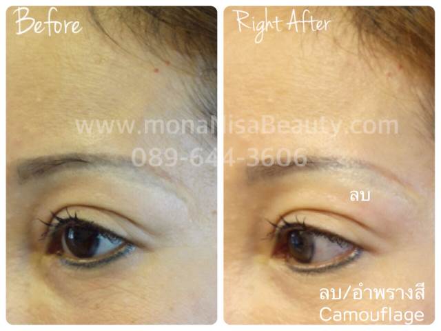 ลบคิ้ว ลบขอบตา