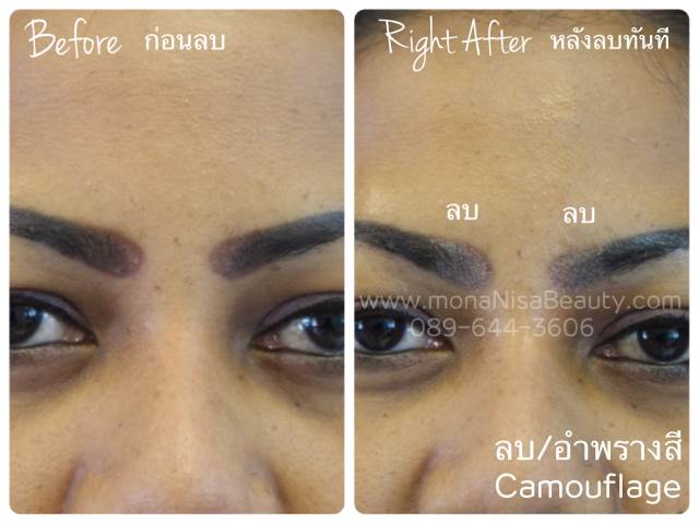 ลบคิ้ว ลบขอบตา