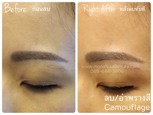 ลบคิ้ว ลบขอบตา