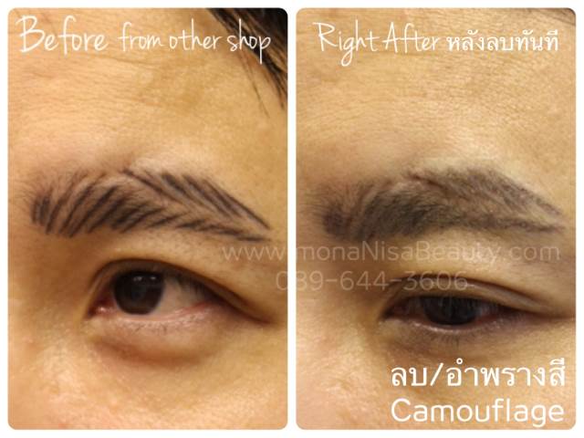 ลบคิ้ว ลบขอบตา