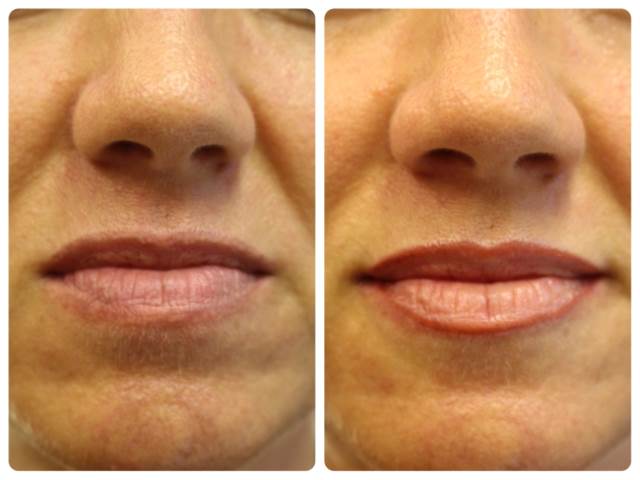 ปากชมพู