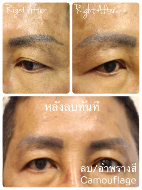 ลบคิ้ว ลบขอบตา