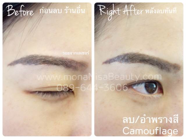 ลบคิ้ว ลบขอบตา