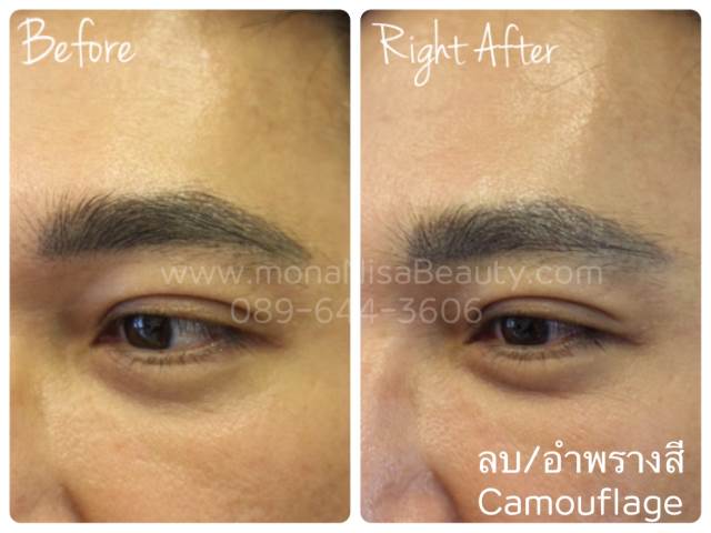 ลบคิ้ว ลบขอบตา