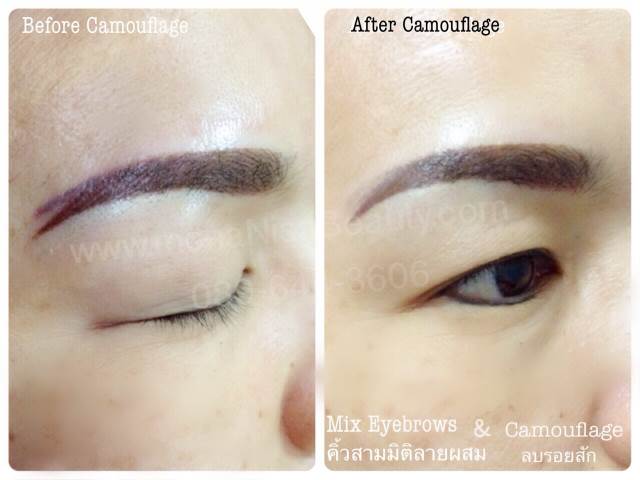 ลบคิ้ว ลบขอบตา