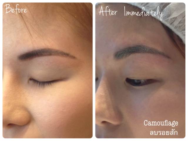 ลบคิ้ว ลบขอบตา