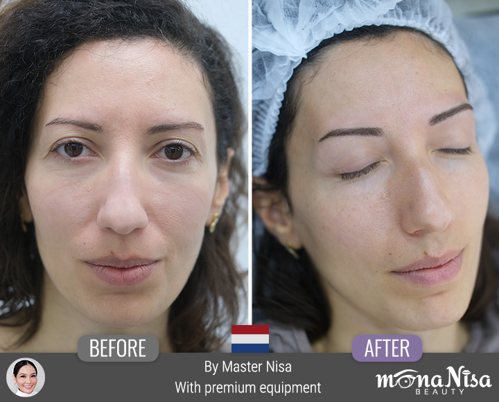 คิ้วสามมิติลายเส้น