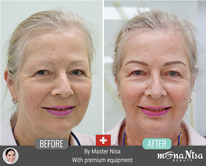 คิ้วสามมิติแบบผสม