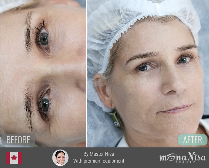 คิ้วสามมิติแบบผสม